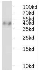 ZADH1 Antibody - BSA Free
