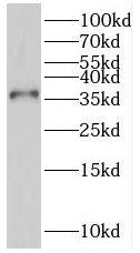 PGR1 Antibody - BSA Free