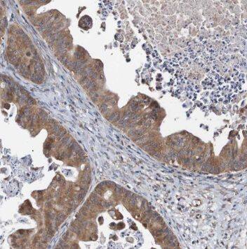 PTER Antibody - BSA Free