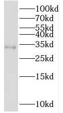 PSMB11 Antibody - BSA Free