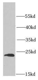 Proteasome beta 1 Antibody - BSA Free
