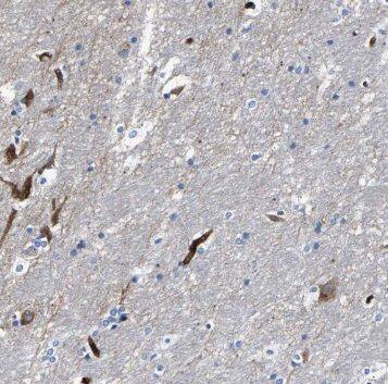 Pregnancy specific beta 1 glycoprotein 11 Antibody - BSA Free