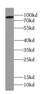 PSD2 Antibody - BSA Free