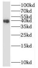 PRRT1 Antibody - BSA Free