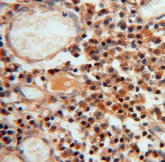 PAP39 Antibody - BSA Free