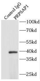 PAP39 Antibody - BSA Free