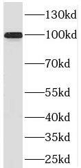 PRPF6 Antibody - BSA Free