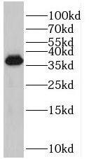 PRPF38A Antibody - BSA Free