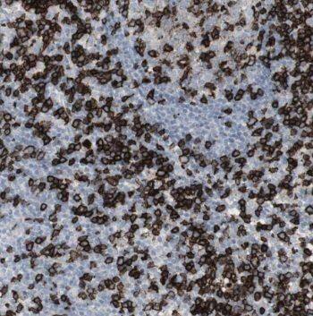 Thymosin alpha 1 Antibody - BSA Free