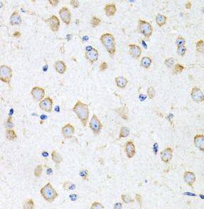 Prokineticin 2 Antibody - BSA Free