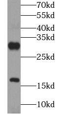 Gastrin-releasing Peptide/Bombesin/Neuromedin C Antibody - BSA Free