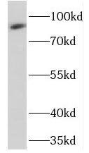 cGK2/PRKG2 Antibody - BSA Free