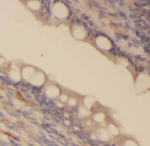 cGK2/PRKG2 Antibody - BSA Free