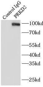 Protein Kinase D2 Antibody - BSA Free