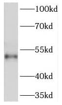 PKA C beta Antibody - BSA Free