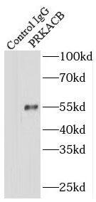 PKA C beta Antibody - BSA Free