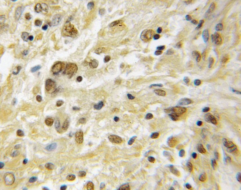 PKA C beta Antibody - BSA Free