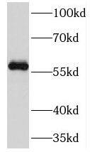 DNA Primase large subunit Antibody - BSA Free