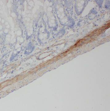 NPY4R Antibody - BSA Free