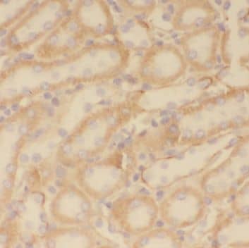 PPT1 Antibody - BSA Free