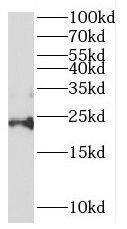 PPPDE1 Antibody - BSA Free