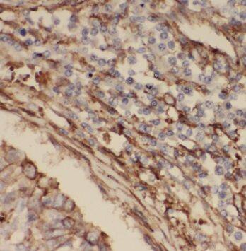 PPPDE1 Antibody - BSA Free