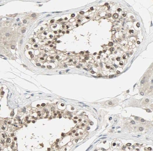 PPP3R2 Antibody - BSA Free