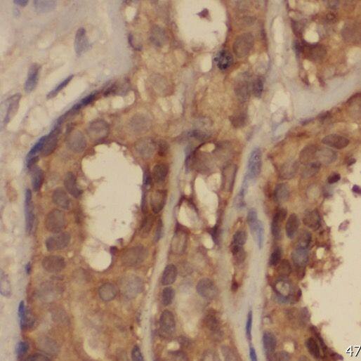 PPP2R2C Antibody - BSA Free