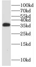 PPP2CB Antibody - BSA Free