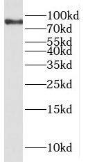 PPP1R3F Antibody - BSA Free