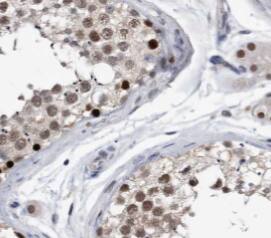 PPP1R2P9 Antibody - BSA Free