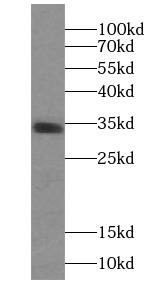 PPP1R2P9 Antibody - BSA Free