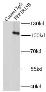 PPP1R15B Antibody - BSA Free