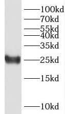 PPP1R14D/GBPI-1 Antibody - BSA Free