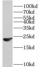 PPP1R14B Antibody - BSA Free