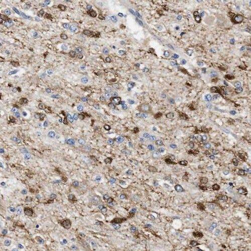 PPM1K Antibody - BSA Free