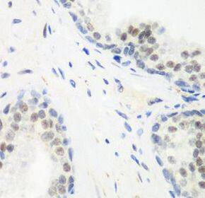 PPAN Antibody - BSA Free