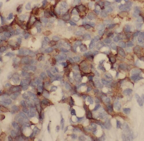 P11 Antibody - BSA Free