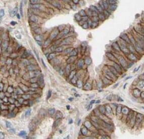 POTED Antibody - BSA Free