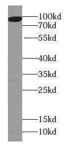 SH3MD2 Antibody - BSA Free