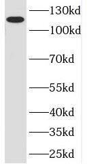 POP1 Antibody - BSA Free