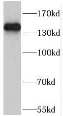 POM121 Antibody - BSA Free