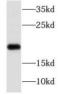 N acetyl transferase 5 Antibody - BSA Free