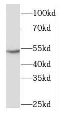 NARF Antibody - BSA Free