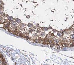 Nanos3 Antibody - BSA Free