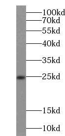 Nanos3 Antibody - BSA Free