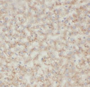 NAGS Antibody - BSA Free