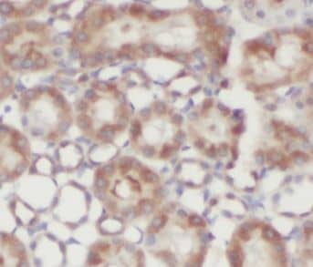 N-Acetyl-D-Glucosamine Kinase/NAGK Antibody - BSA Free