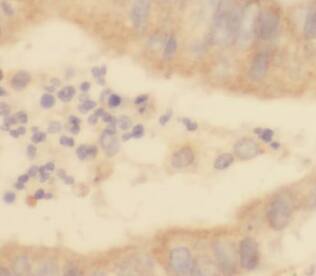SSNA1 Antibody - BSA Free
