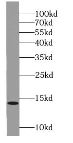 SSNA1 Antibody - BSA Free